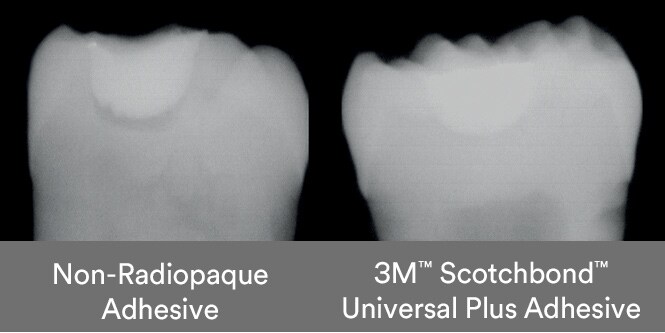 x-ray of teeth
