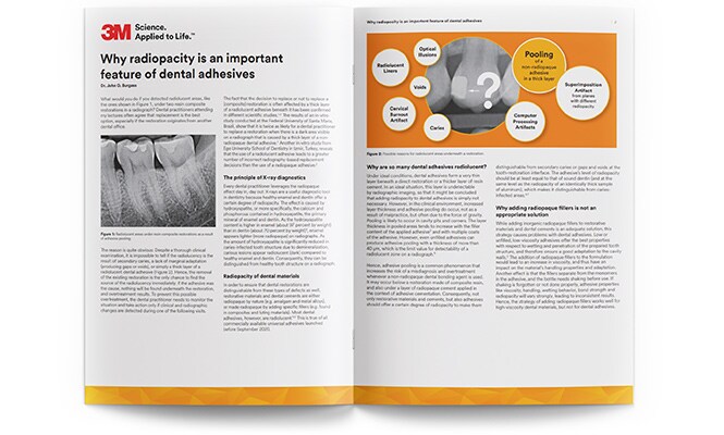 Dental adhesives whitepaper thumbnail
