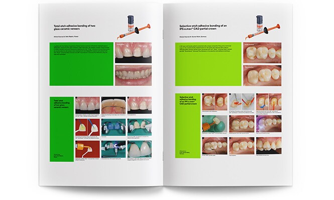 3M RelyX Clinical case collection
