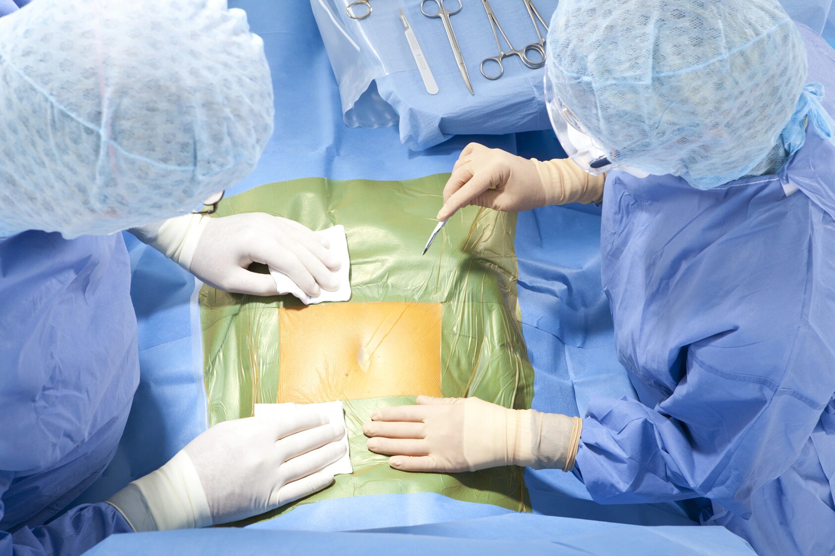 A surgeon and assist prepare to make an incision on patient with Ioban drapes applied to skin
