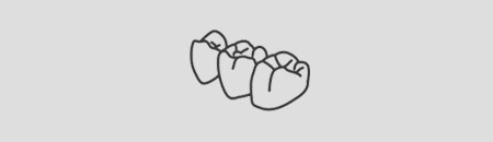 Icon Showing Indirect Dental Restorative Solutions
