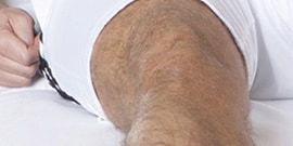 Do not remove hair